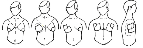 image of 5 steps to apply transtape to bind the chest.